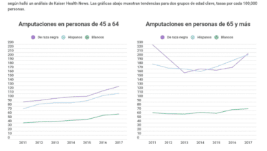 Latinos tienen doble probabilidad de una amputación por diabetes